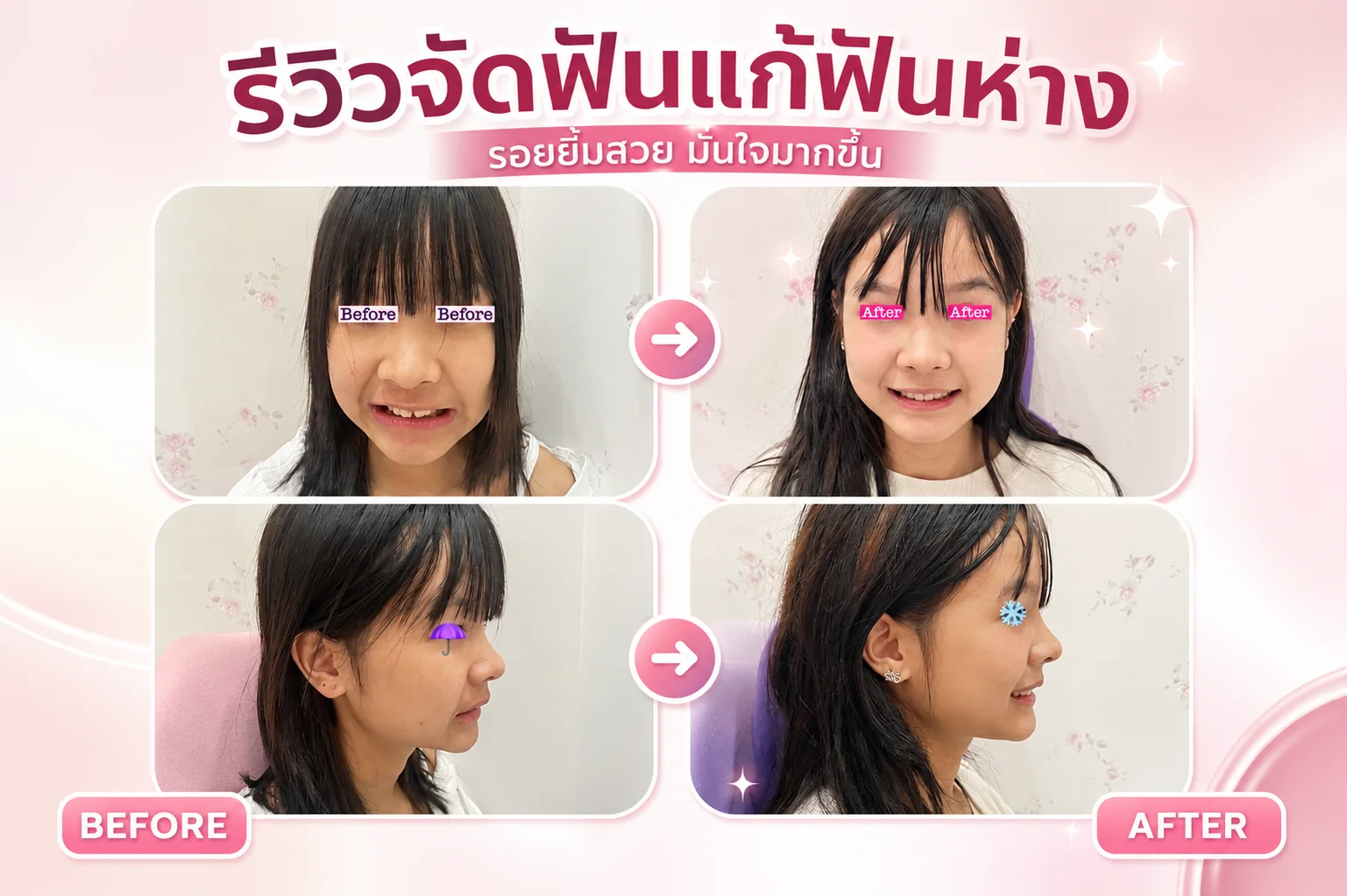 ทันตกรรมจัดฟัน (Orthodontics)